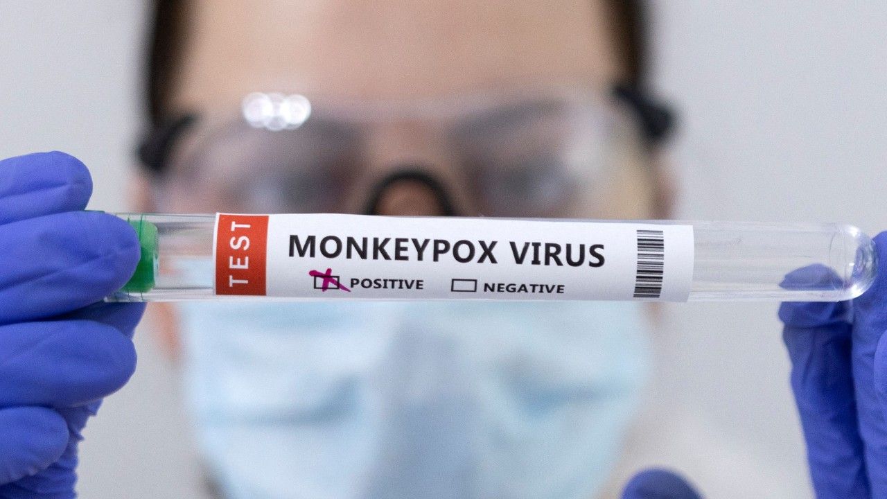 Confirman primer caso de viruela del mono en México