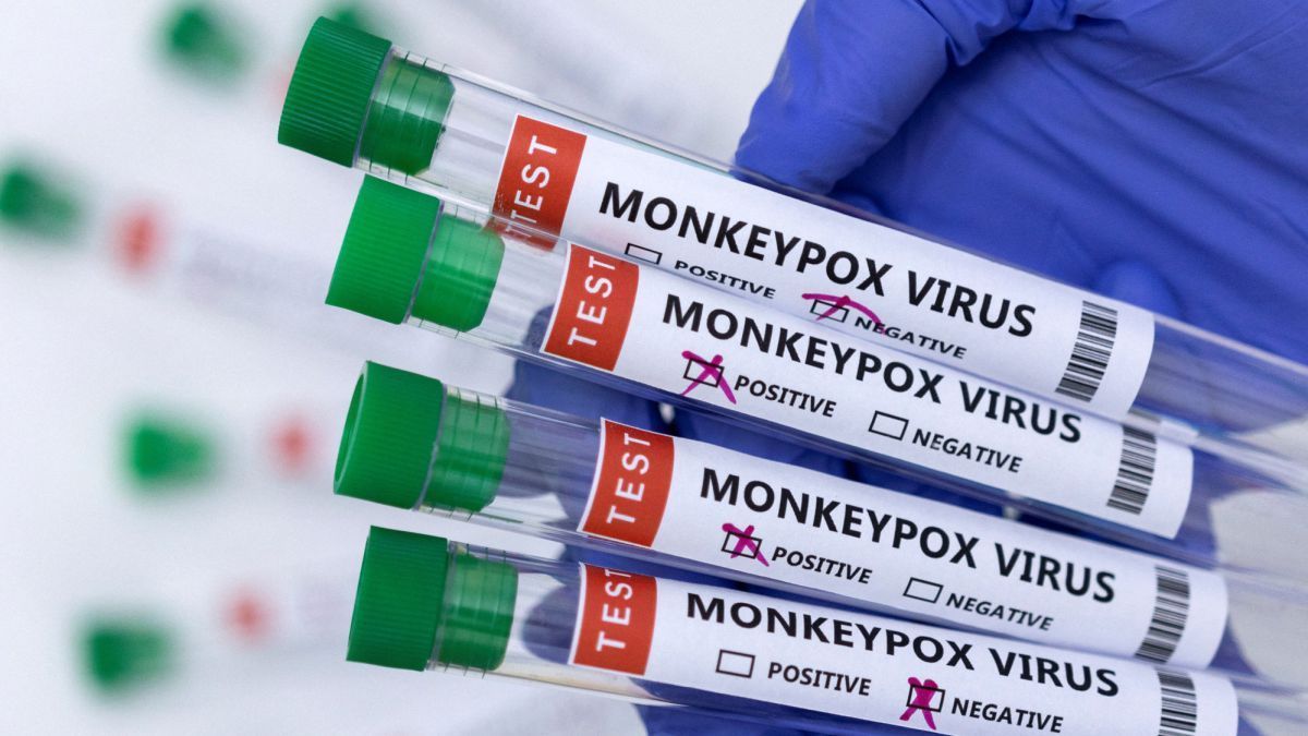Recomiendan vacunar a hombres y personas trans contra viruela del mono, en Francia