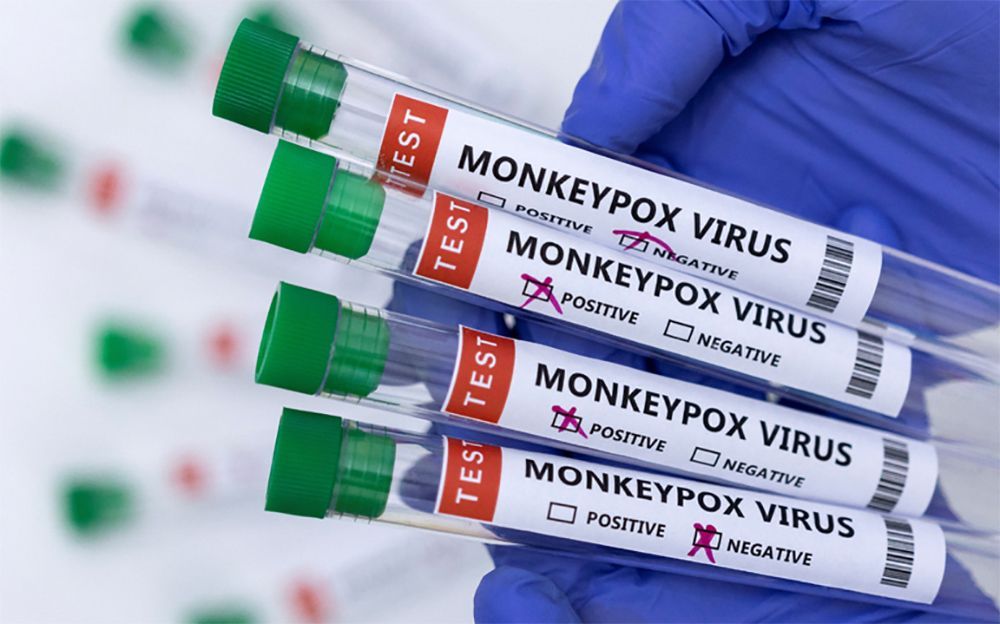 Aumentan 20 % los contagios de viruela del mono en una semana: OMS