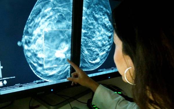 ▶ Oaxaca, entre los estados del país con la menor mortalidad por cáncer de mama