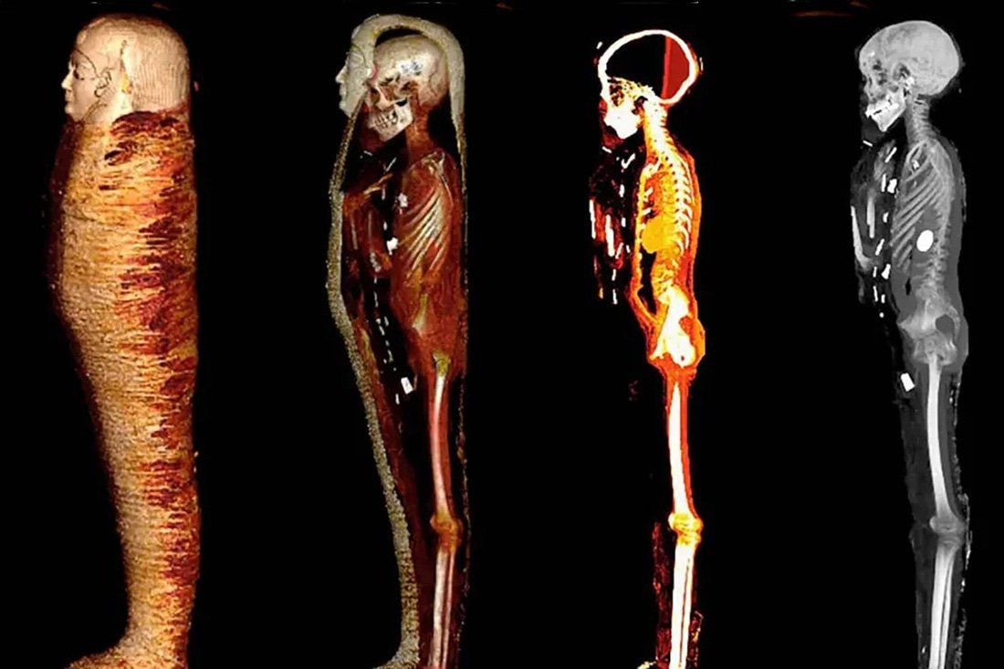 Revelan secretos de una momia de 2.300 años de antigüedad a través de un escáner digital