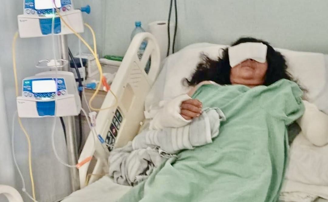 Tras ataque de pitbulls a runner, la Fiscalía de Oaxaca «olvida» buscar a dueño para que asuma responsabilidad