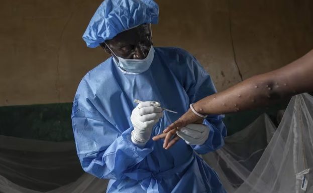 OMS mantiene el nivel más alto de alerta por la epidemia de mpox; los casos siguen aumentando