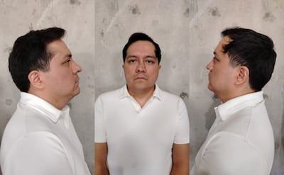 Reo procesado por homicidio escapa de clínica de Tlacolula, Oaxaca, con ayuda de motociclista y auto VW Jetta Reo procesado por homicidio escapa de clínica de Tlacolula, Oaxaca, con ayuda de motociclista y auto VW Jetta