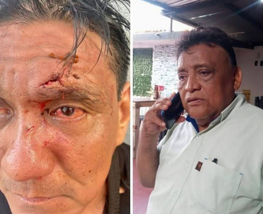 Funcionario del COBAO en Tehuantepec es señalado por agredir al periodista tras denuncias de corrupción Funcionario del COBAO en Tehuantepec es señalado por agredir al periodista tras denuncias de corrupción