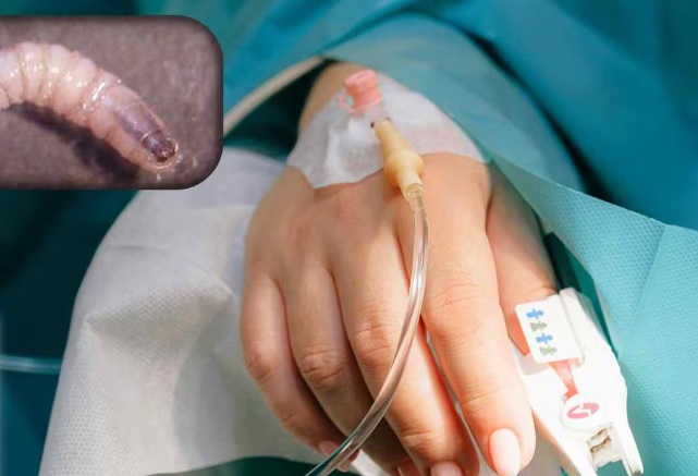 Confirman 17 casos de miasis en humanos por gusano barrenador; Chiapas y Campeche concentran los contagios