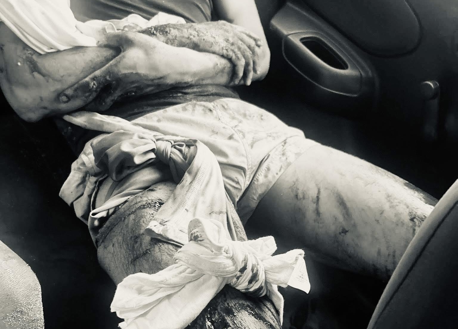 Cocodrilo ataca a dos turistas en playa Ventanilla, en la costa de Oaxaca; ambos están estables tras incidente