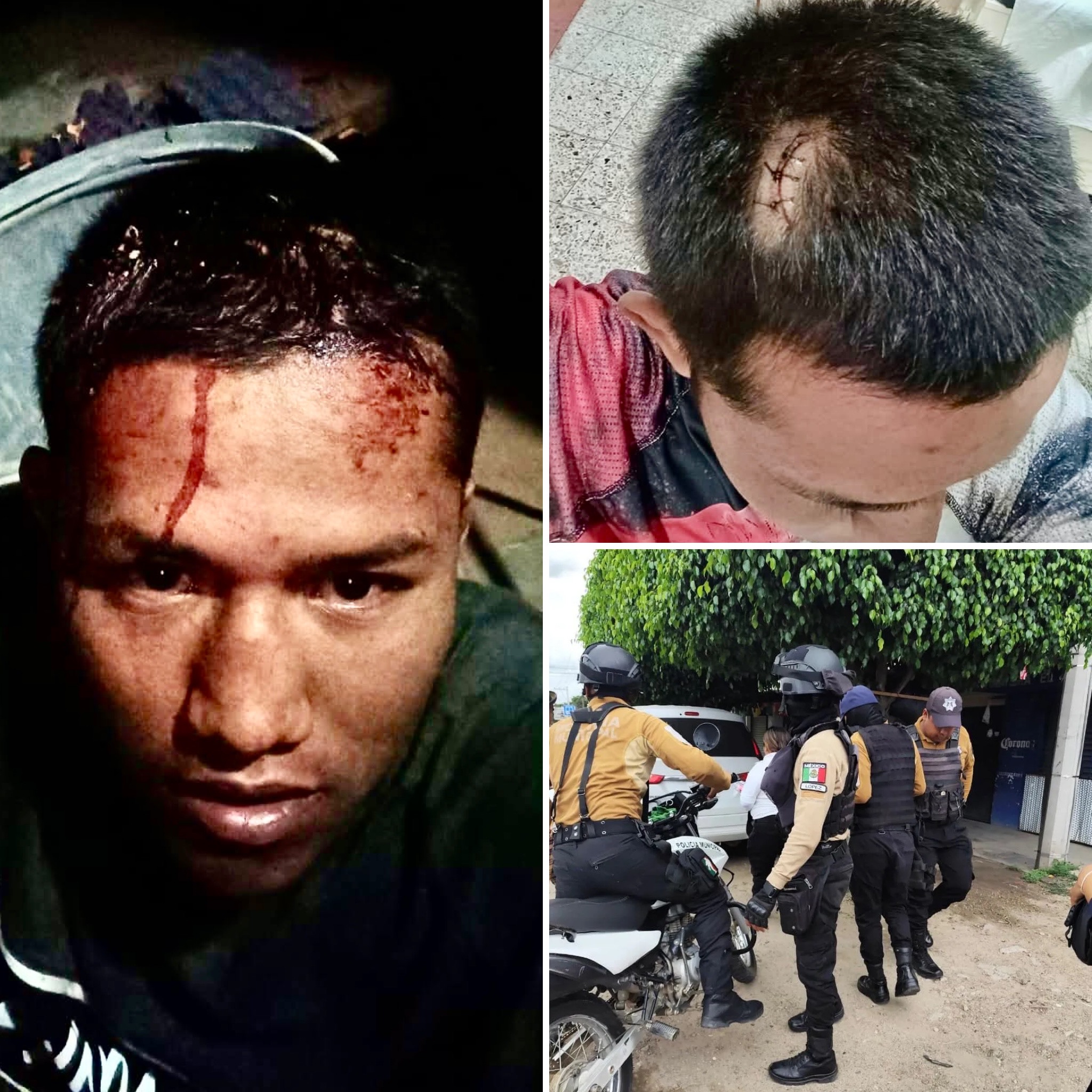 Abusos policiales en Oaxaca: estudiantes y deportistas víctimas de golpizas sin castigo ni supervisión oficial Abusos policiales en Oaxaca: estudiantes y deportistas víctimas de golpizas sin castigo ni supervisión oficial