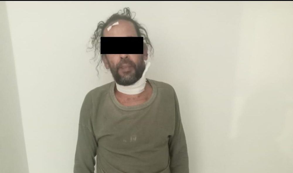 Vinculan a proceso a capitalino por crueldad animal: rescatan 65 perros en San Francisco Lachigoló