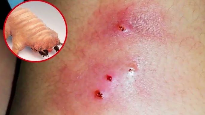 Oaxaca: confirman primer fallecimiento humano por gusano barrenador; el estado, tercer lugar nacional por número de casos