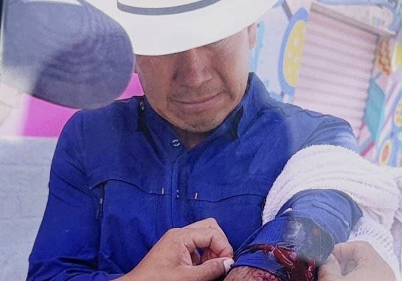 Atacan a balazos a César Figueroa, presidente municipal de Miahuatlán, Oaxaca, durante supervisión de obra; hay dos heridos Atacan a balazos a César Figueroa, presidente municipal de Miahuatlán, Oaxaca, durante supervisión de obra; hay dos heridos