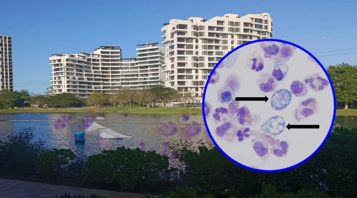 ‘Ameba comecerebros’ en México: confirman su presencia en lago artificial de Plaza La Isla Mérida ‘Ameba comecerebros’ en México: confirman su presencia en lago artificial de Plaza La Isla Mérida