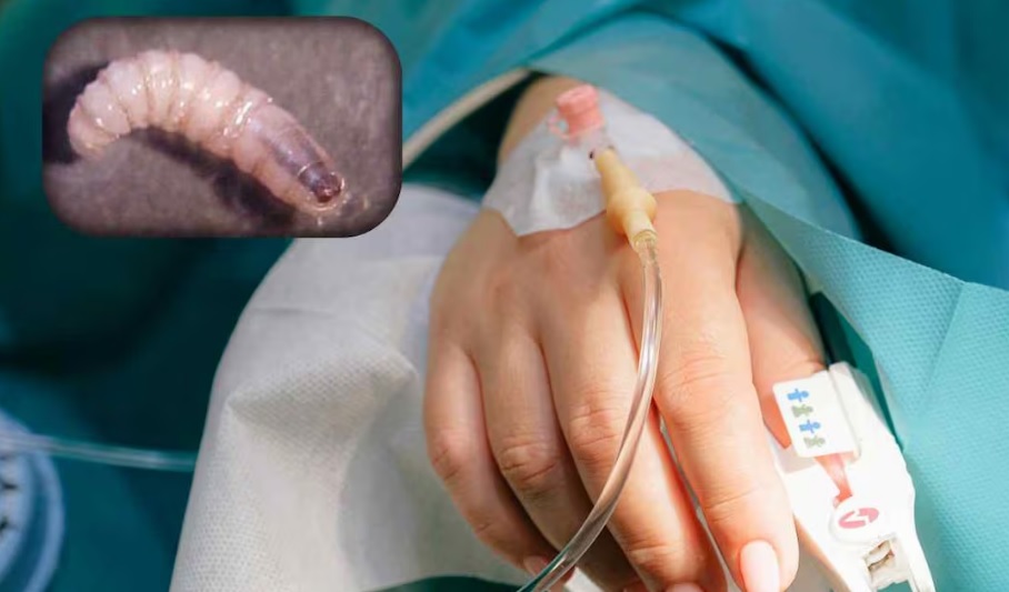 Casos de gusano barrenador en humanos se quintuplican en 2026; México suma 692 contagios y 4 muertos Casos de gusano barrenador en humanos se quintuplican en 2026; México suma 692 contagios y 4 muertos